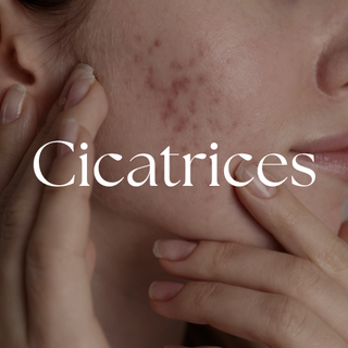 Cicatrices