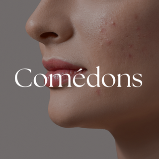 comedons